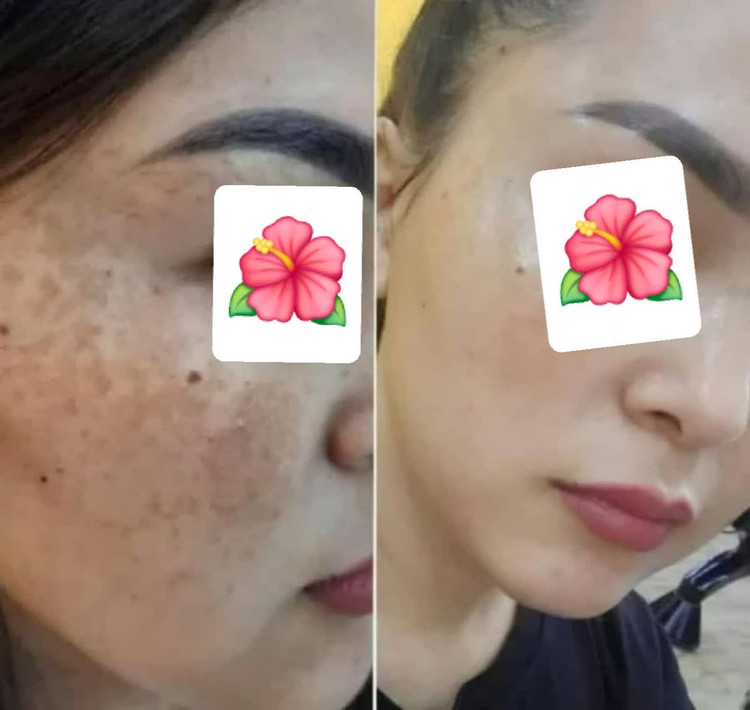 کرم بیوممتیک ضد لک لاکچری کوین