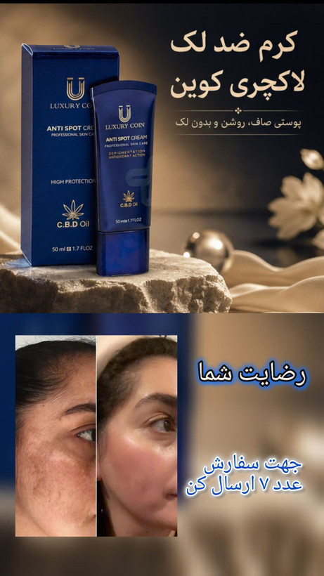 کرم بیوممتیک ضد لک لاکچری کوین