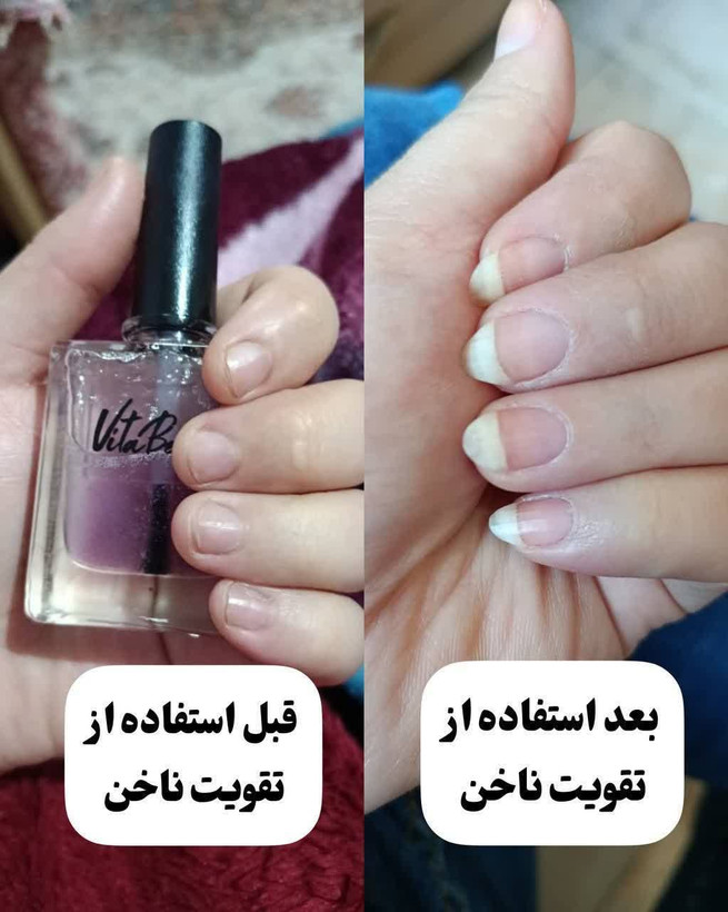 سرم دو فاز تقویت ناخن و کوتیکول