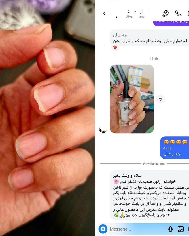 سرم دو فاز تقویت ناخن و کوتیکول